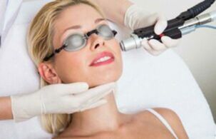 Procedimento de rejuvenescimento da pele facial a laser