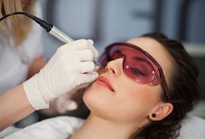 Biorevitalização a laser
