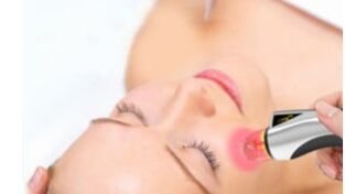 Rejuvenescimento a laser do rosto