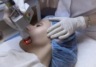 O processo de rejuvenescimento