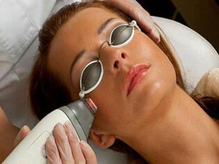 rejuvenescimento facial a laser