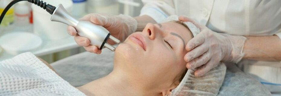 procedimento de rejuvenescimento facial a laser fracionado
