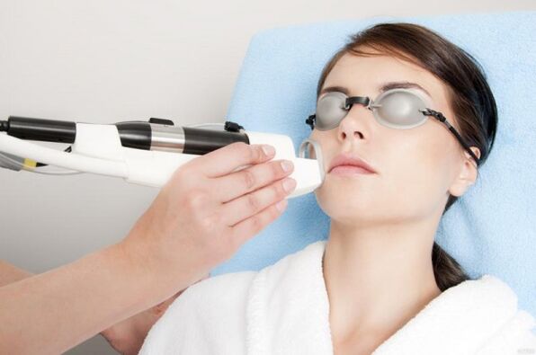realizando um procedimento de rejuvenescimento da pele a laser